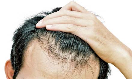 Hair Loss and Erectile Dysfunction Help is Just a Call Away